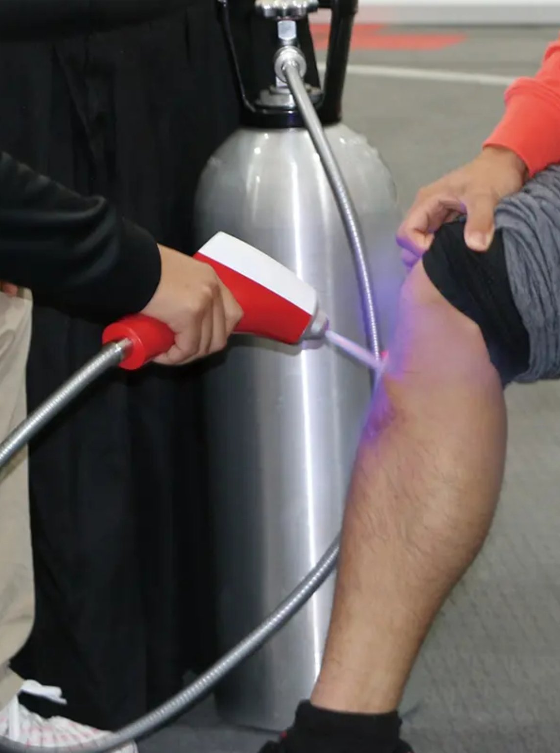co2 cryotherapy (366 492).jpg