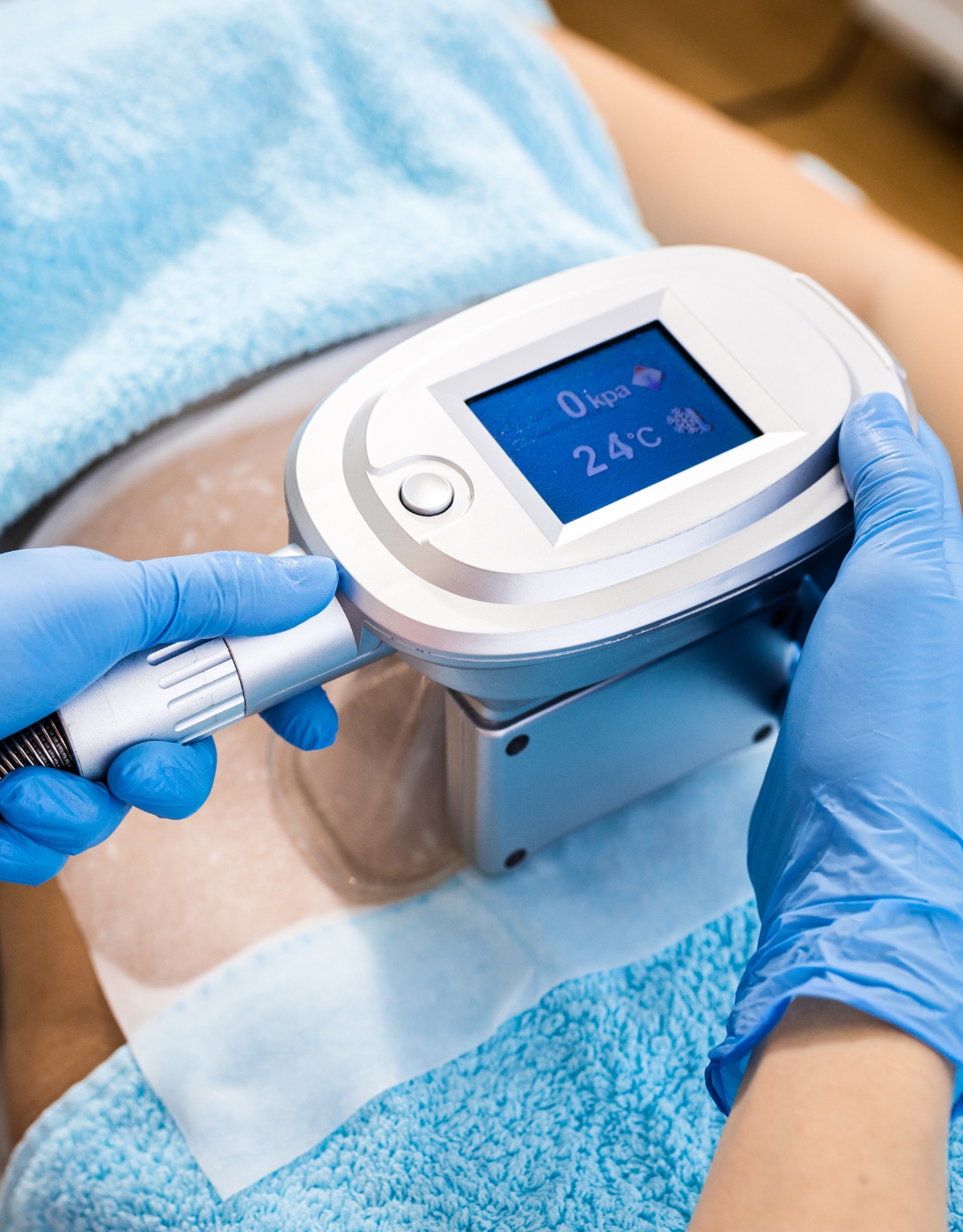cryolipolysis.jpg