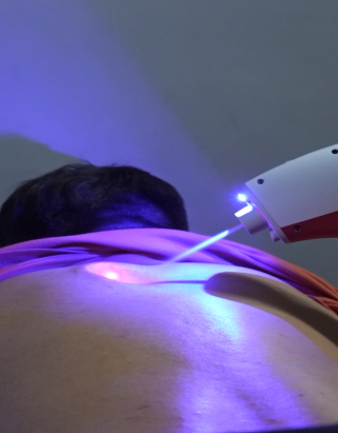 laser lipolysis.jpg