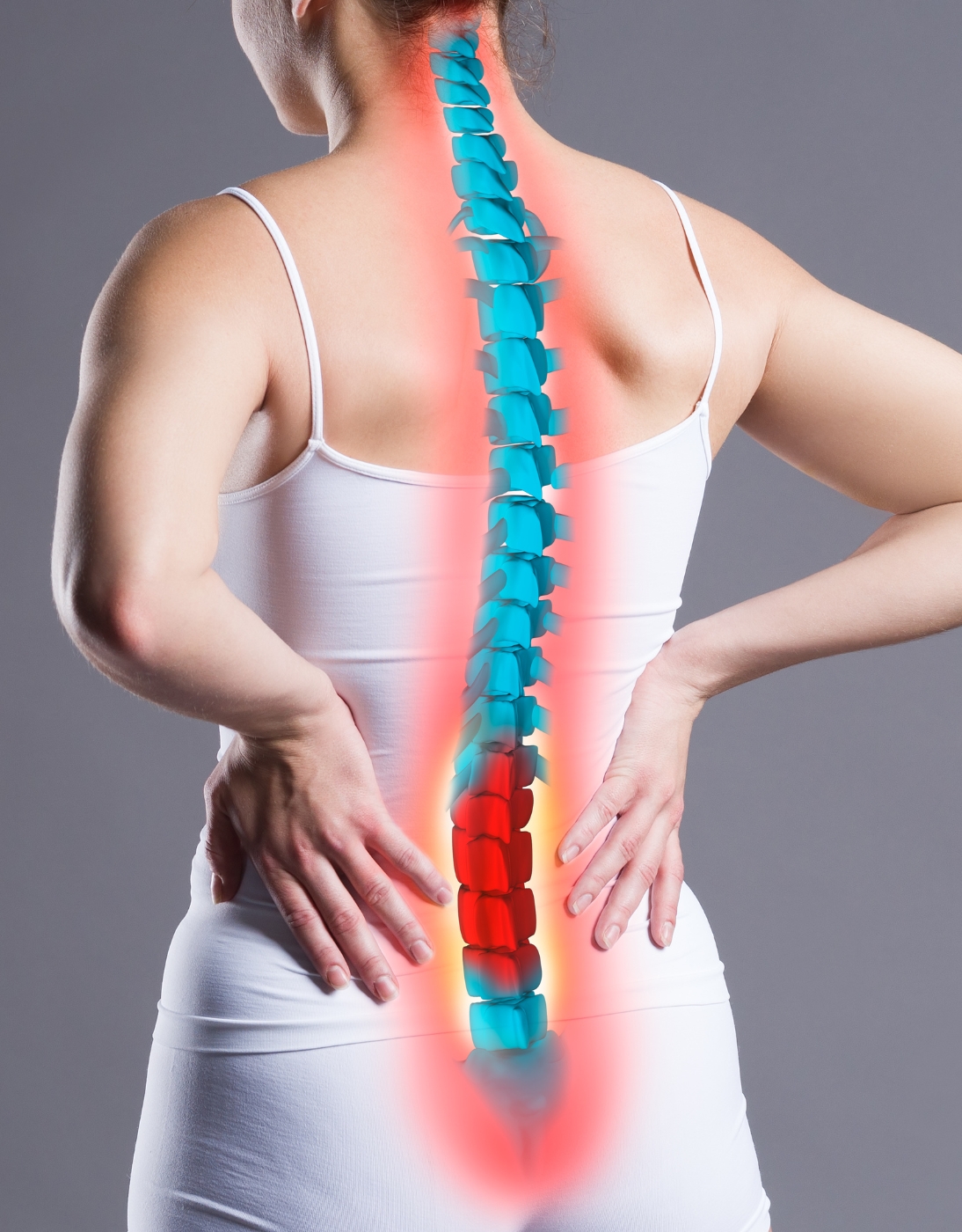 sciatica.jpg